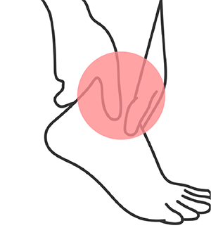 足首・ふくらはぎの怪我