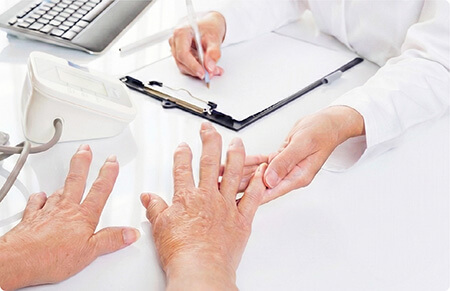 関節リウマチの治療